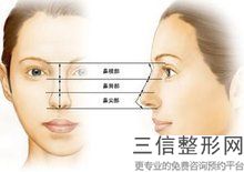 3D隆鼻整形的價(jià)格、效果、副作用等詳細(xì)介紹