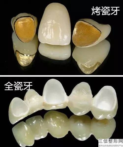 大連洗牙一次多少錢？大連齒醫生醫院的專家們告訴大家