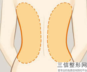 如何減腿部的脂肪呢