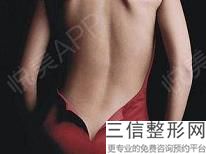 面部吸脂和整容有什么好處？吸脂的科學原理是什么？