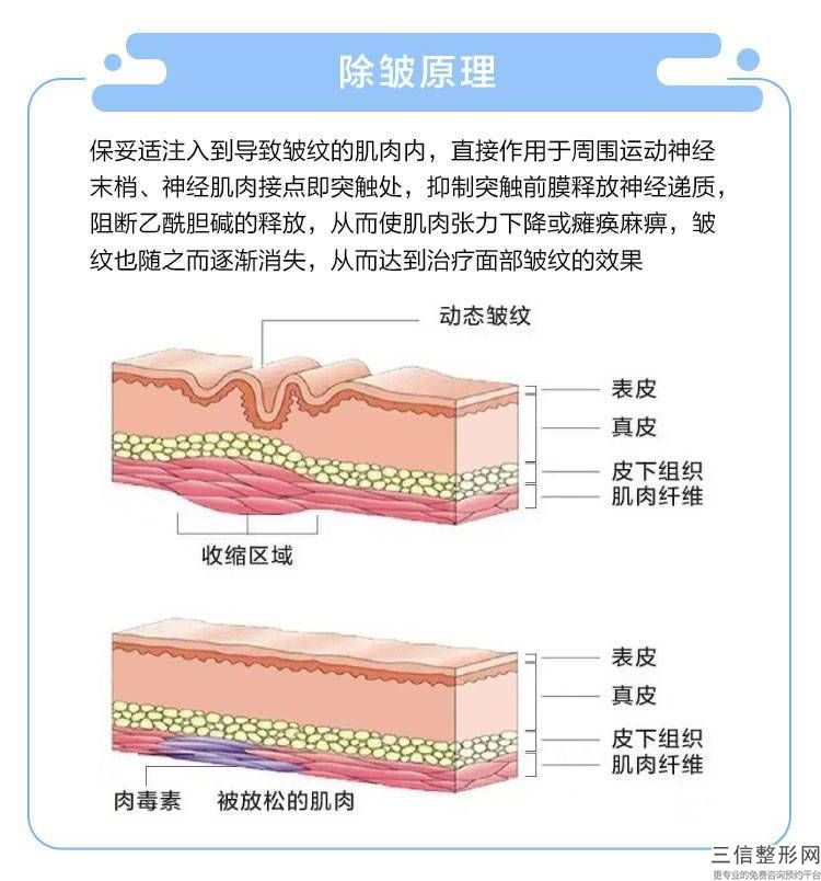 痘疤恢復正常需要多長時間？去除疤痕的方法有哪些