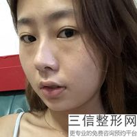 深圳的陰唇之美在哪里？?jī)r(jià)格是多少？？