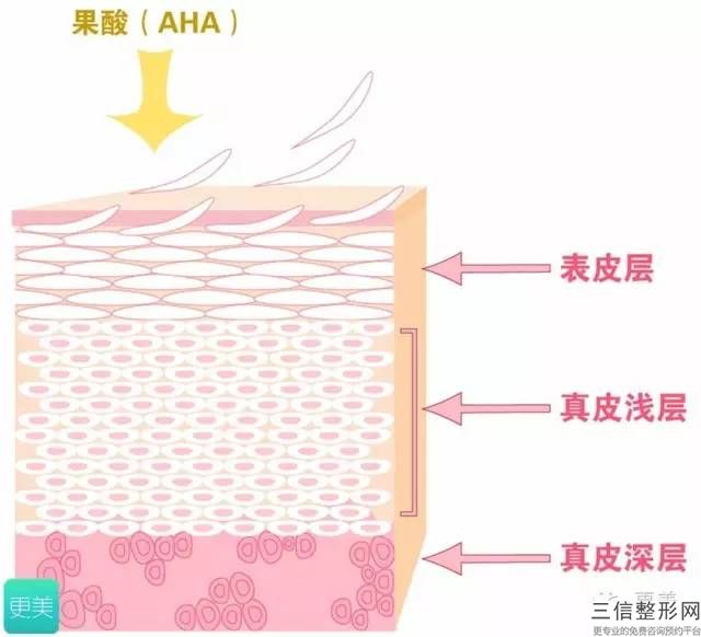 做膠原蛋白注射去除皺紋危險嗎？讓我們邀請整形專家介紹一下