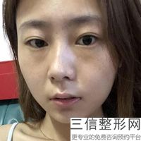 青島紋唇浮唇在哪里？?jī)r(jià)格是多少？(圖)