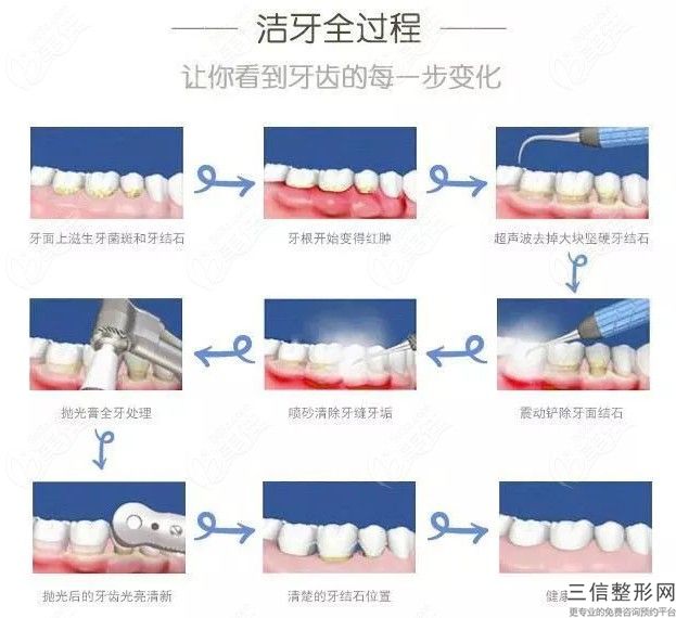 做烤瓷牙的利弊？