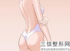 吸脂瘦身(Liposuction)的獲得的效果好嗎