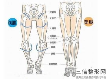 臀部吸脂的價格多少(臀部大腿吸脂價格)