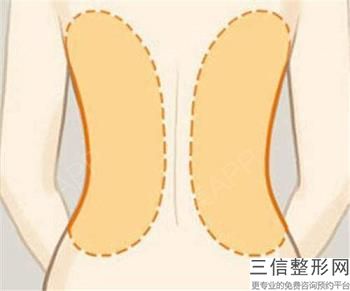 通化「重大通知」面部激光溶脂效果好嗎,—真相揭秘，難怪...