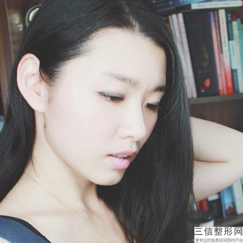 黃牙能美白嗎，牙黃做什么可以美白