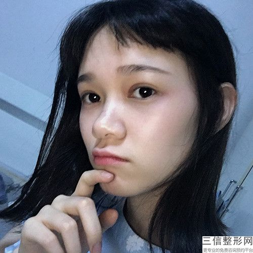 長沙雙眼皮整形醫院排名！長沙雅美醫療美容醫院不容錯過