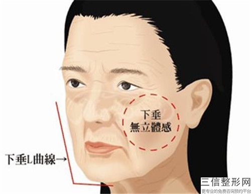 開封注射瘦臉針美容術的價格費用（瘦臉針注射費收費標準）