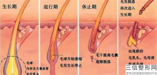 晉城市SHT毛發(fā)種植排名前八全新一覽提醒-晉城市SHT毛發(fā)種植整形醫(yī)院