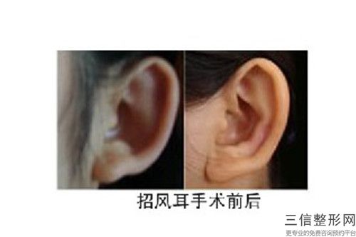 自貢市招風(fēng)耳治療醫(yī)生排名榜top10強(qiáng)名氣遠(yuǎn)揚(yáng)-陳琳醫(yī)生公立口碑好