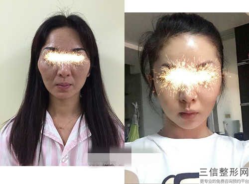 重慶市顴弓降低醫院排名前十名花名冊一覽-重慶愛美醫療美容門診部這幾位技壓全場