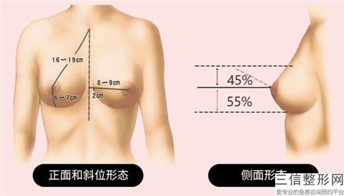 鄭毅整形醫生-鄭毅醫師胸毛用激光治療口碑真實評價反饋