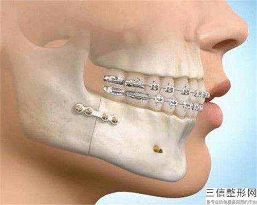 2023年吉林省種植牙齒烤瓷牙醫院十強排名榜名單爆料-吉林省種植牙齒烤瓷牙口腔醫院