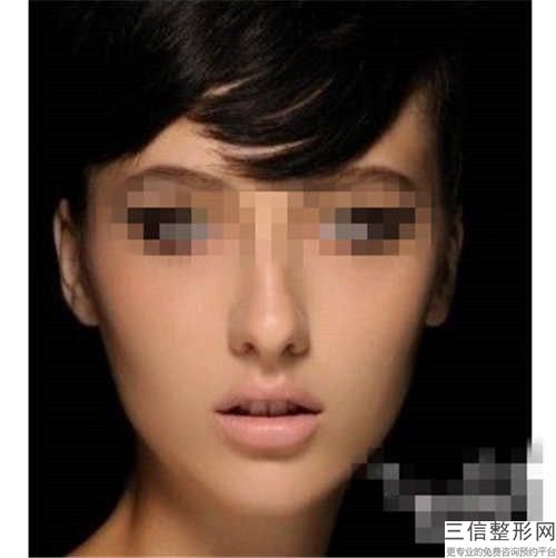 瀘州韓美整形美容門診部?jī)r(jià)格表一覽費(fèi)用揭露-瀘州韓美整形美容門診部唇腭裂手術(shù)修復(fù)手術(shù)價(jià)格是如何呢