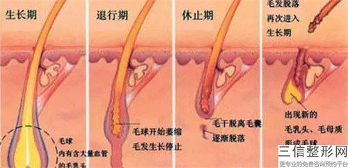 常德e脫毛手術費用大概要多少錢「常德e脫毛價格4大因素」