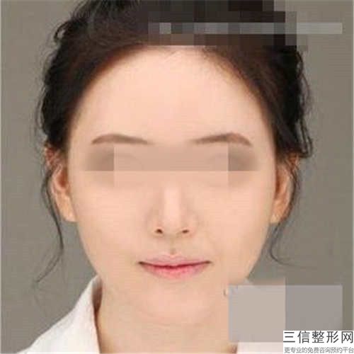 婁底湘中整形美容醫院手術修復兔唇項目婁底湘中整形美容醫院醫生奪魁