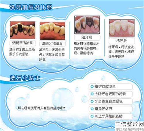 駐馬店合金烤瓷牙整形手術出現風險該如何應對