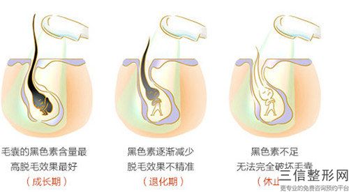 焦作衛校醫療整形美容中心e光脫腋毛費用到底是多高