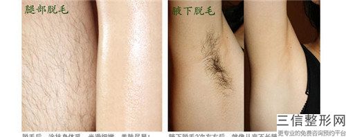 國內(nèi)光子脫大腿毛醫(yī)院推薦：光子脫大腿毛醫(yī)院前50佳哪個(gè)技術(shù)比較好