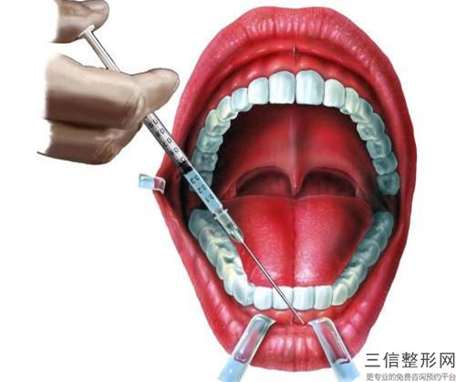 邢臺市第三醫院口腔科價格表(費用)2023快來種草-槽牙拔案例