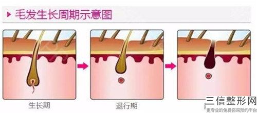 宿遷毛發移植種胡須大概費用是多少啊