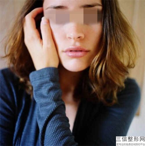 天津福斕醫療美容整形價位表全新曝光2023-嘟嘟唇紋唇案例