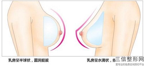 本溪乳房縮小整形整形手術(shù)對身體有害效果又如何