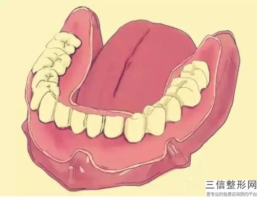 儋州牙周水激光手術過后效果會反彈嗎