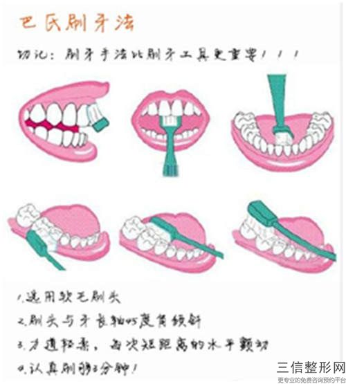 遼陽鐵箍牙齒術后有沒有副作用