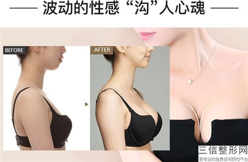 美容輕松矯正乳房下垂醫院推薦：輕松矯正乳房下垂醫院20強公示