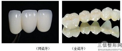 恩施氧化鋯烤瓷牙的術后效果怎么樣