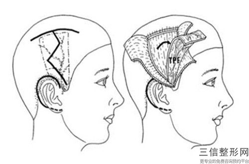 國內生物再造耳醫院推薦：生物再造耳醫院TOP50強慕了