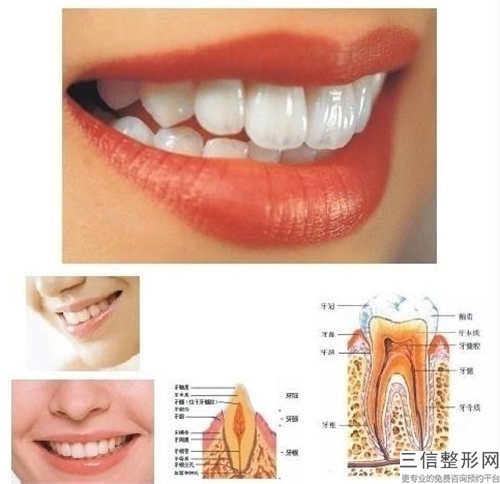 美國3M進口樹脂補牙的安全性