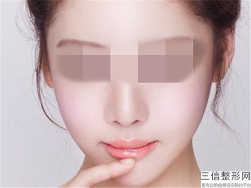 昌吉3D美牙貼面術適應人群有幾類