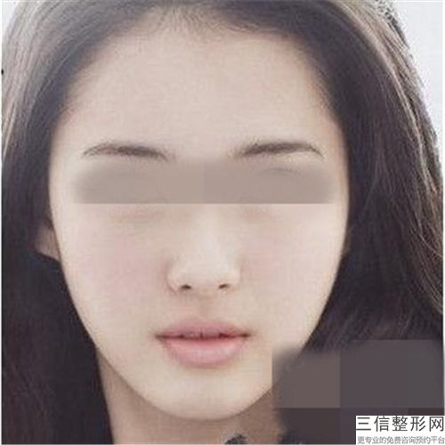 內(nèi)江洋子美容整形醫(yī)院伊維蘭墊下巴哪家好