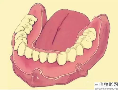 晉中松牙根管內(nèi)固定術美容做完以后能保持多久