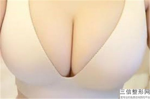 舟山艾美醫療美容醫院縮小乳暈手術需要價格多少呢