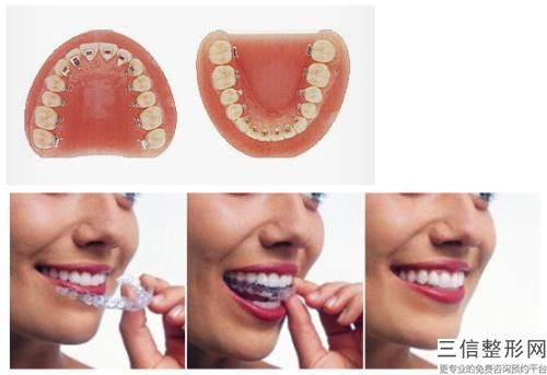 錦州空軍醫(yī)院整形科牙齒突出修復手術的安全性如何
