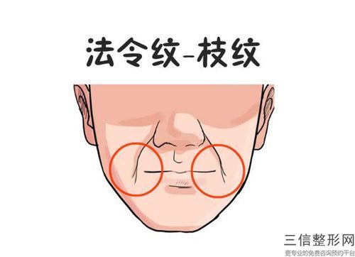 全國做線雕除皺醫院推薦：做線雕除皺醫院前50位新提名