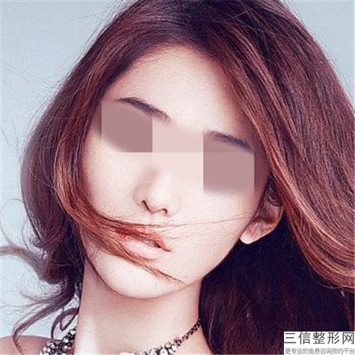 吉大一院美容整形外科價格(價目)表超人氣項目2025曝光-吸脂祛雙下巴案例