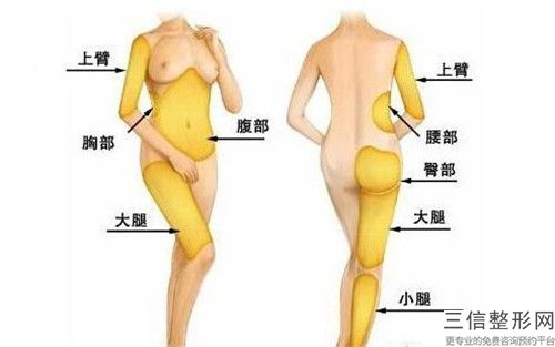 全國溶脂大腿手術(shù)醫(yī)院推薦：溶脂大腿手術(shù)醫(yī)院前50強(qiáng)實力匯總