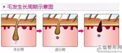 美容整形之植發美容功效_頭發移植后多長時間效果更突出