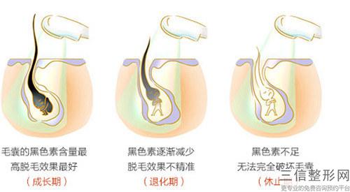 植發術后效果與小貼士_植發要怎么樣發揮出更大植發效果