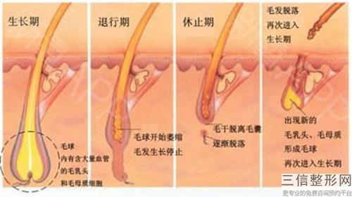 移植毛發一般要多少元？