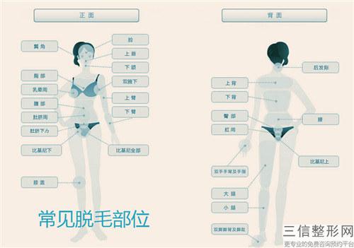 激光去毛術的治療結果只能維持2年嗎