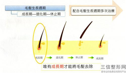 做激光脫毛美容整形法治療以后還會重新長出毛發嗎